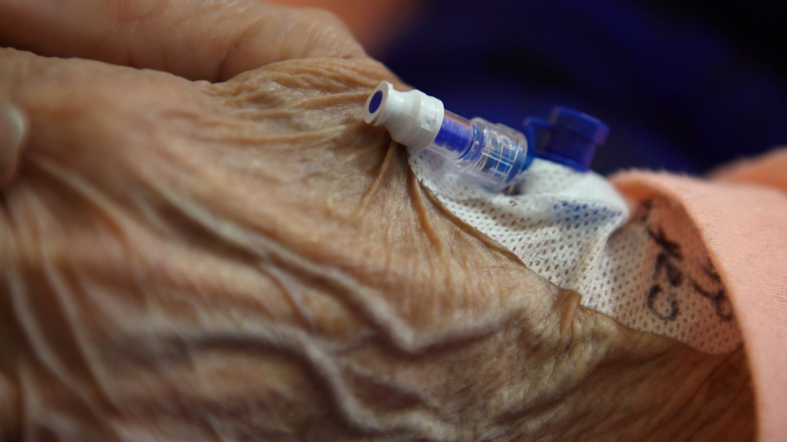 Intravenous cannula placed in the hand of an elderly patient for palliative care of a terminal patient.